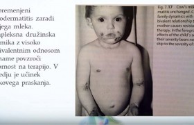 1. sklop predavanja alergije (9. del)